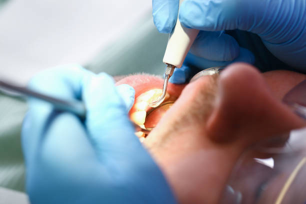 Best Weekend Emergency Dentist in Lisbon, OH
