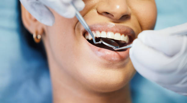 Best Emergency Broken Tooth Repair in Lisbon, OH